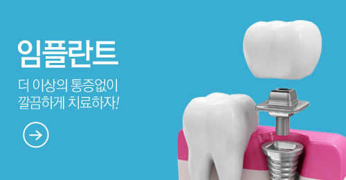 임플란트